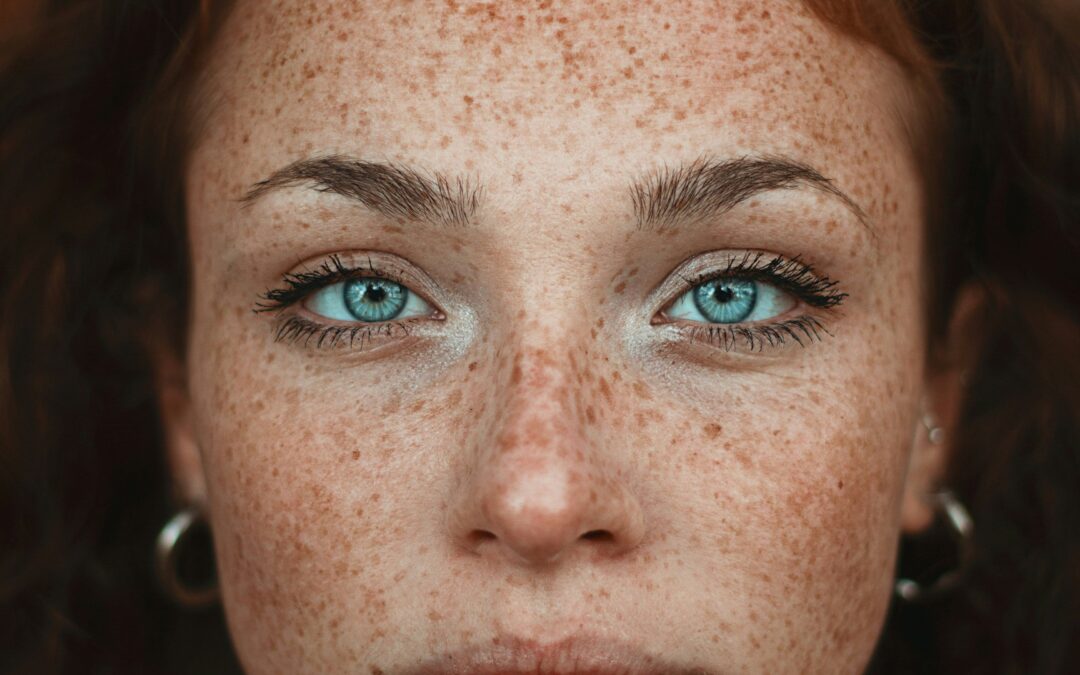 Macchie Cutanee: Ritrova la Luminosità della Tua Pelle con Soluzioni Efficaci e Delicate